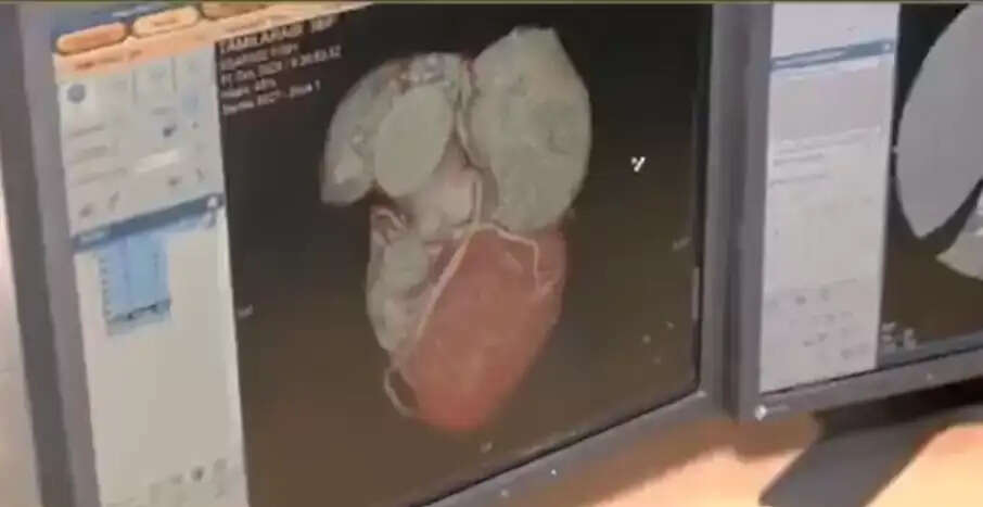 ஸ்கேன் எம்.ஆர்.ஐ. ஓமந்தூரார்