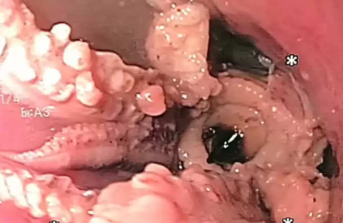 ஆக்டோபஸ் 