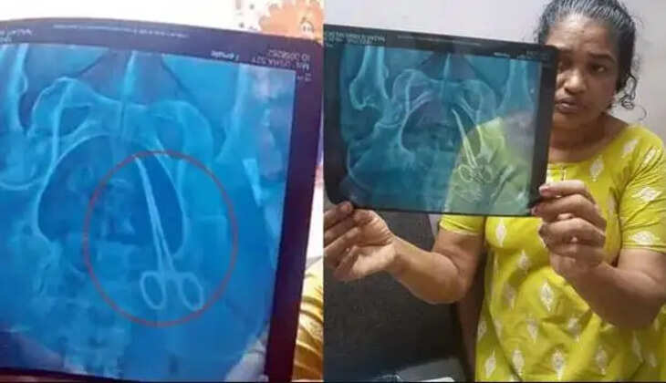 வயிற்றில் கத்திரிக்கோல்