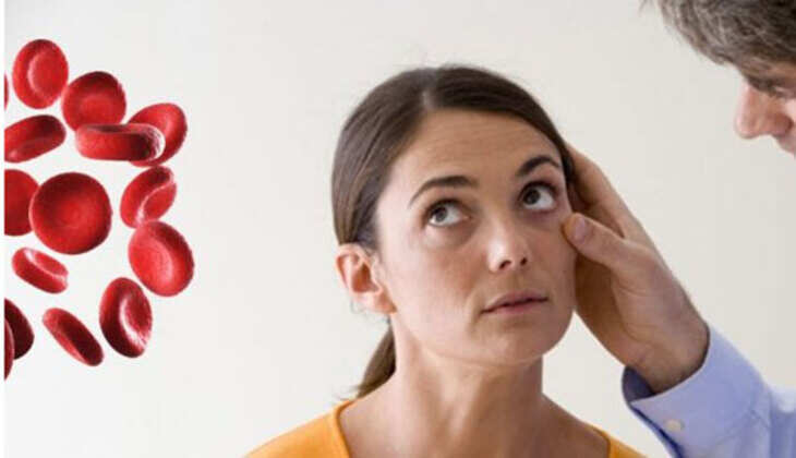 ரத்த சோகை