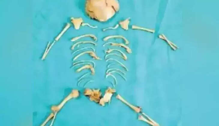 குழந்தை எலும்புக்கூடு