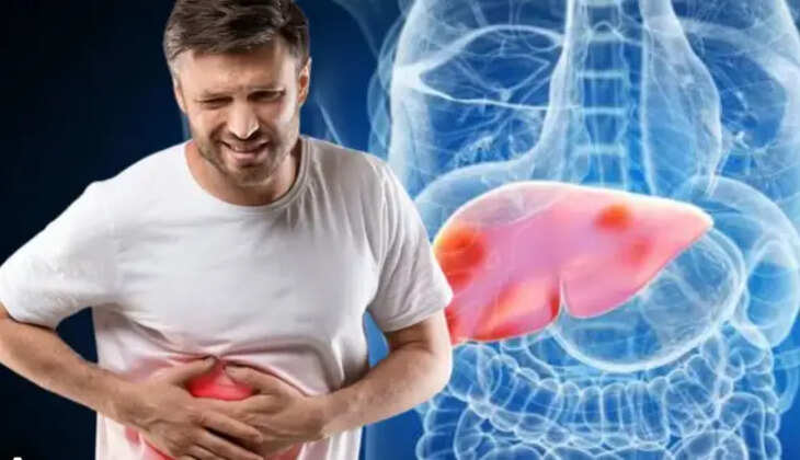 கொழுப்பு கல்லீரல் நோய்