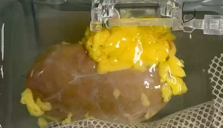 சிறுநீரகம்