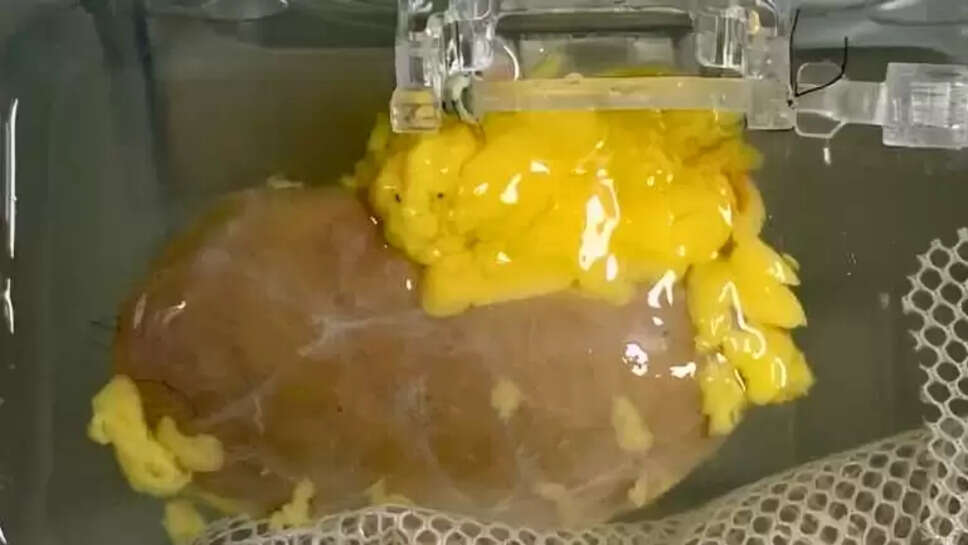 சிறுநீரகம்