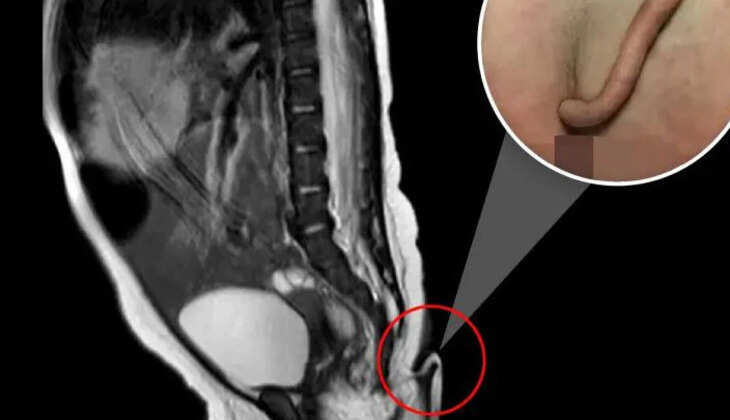 வால் குழந்தை