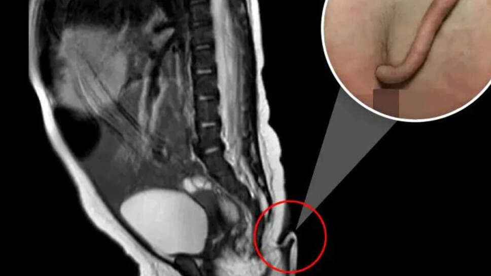 வால் குழந்தை