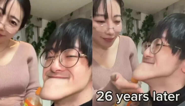 வைரல் வீடியோ... உலகிலேயே மிக மிக நீளமான தாடை கொண்ட இளைஞர் .... விட்டுச்சென்ற காதலி! 