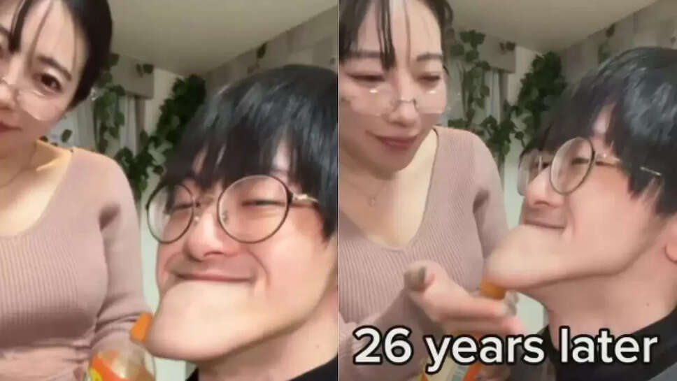 வைரல் வீடியோ... உலகிலேயே மிக மிக நீளமான தாடை கொண்ட இளைஞர் .... விட்டுச்சென்ற காதலி!&nbsp;