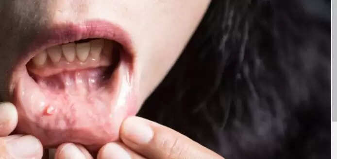 புற்றுநோய்