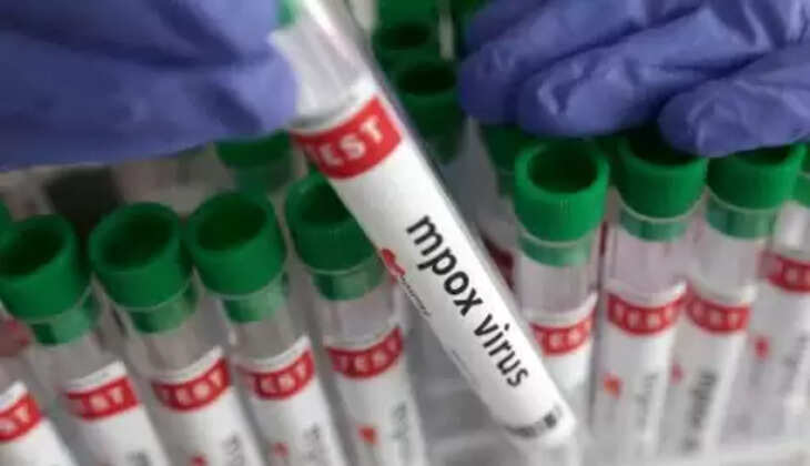  குரங்கு அம்மை