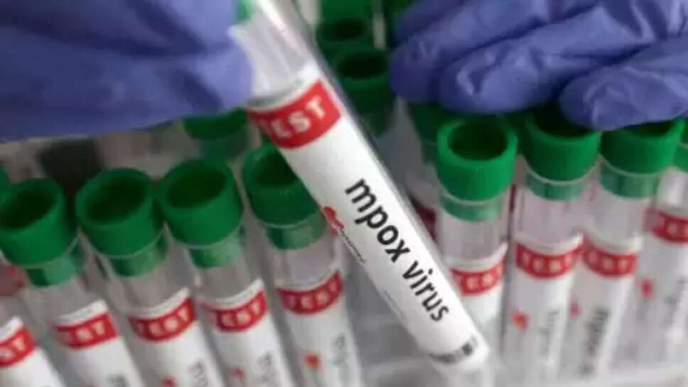  குரங்கு அம்மை