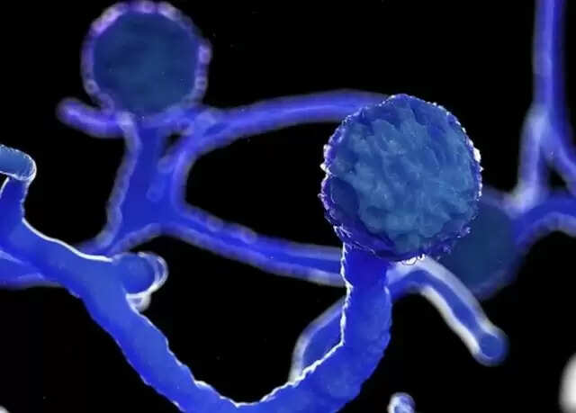 ஆந்த்ராக்ஸ்