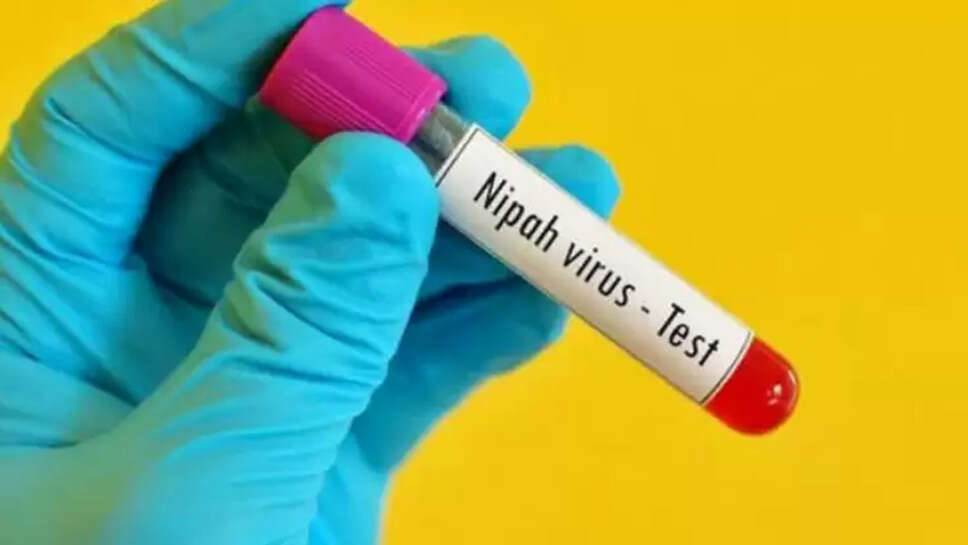 நிபா வைரஸ்