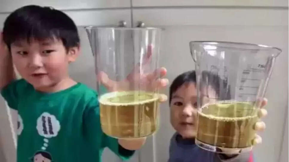 சீனா சிறுநீர்