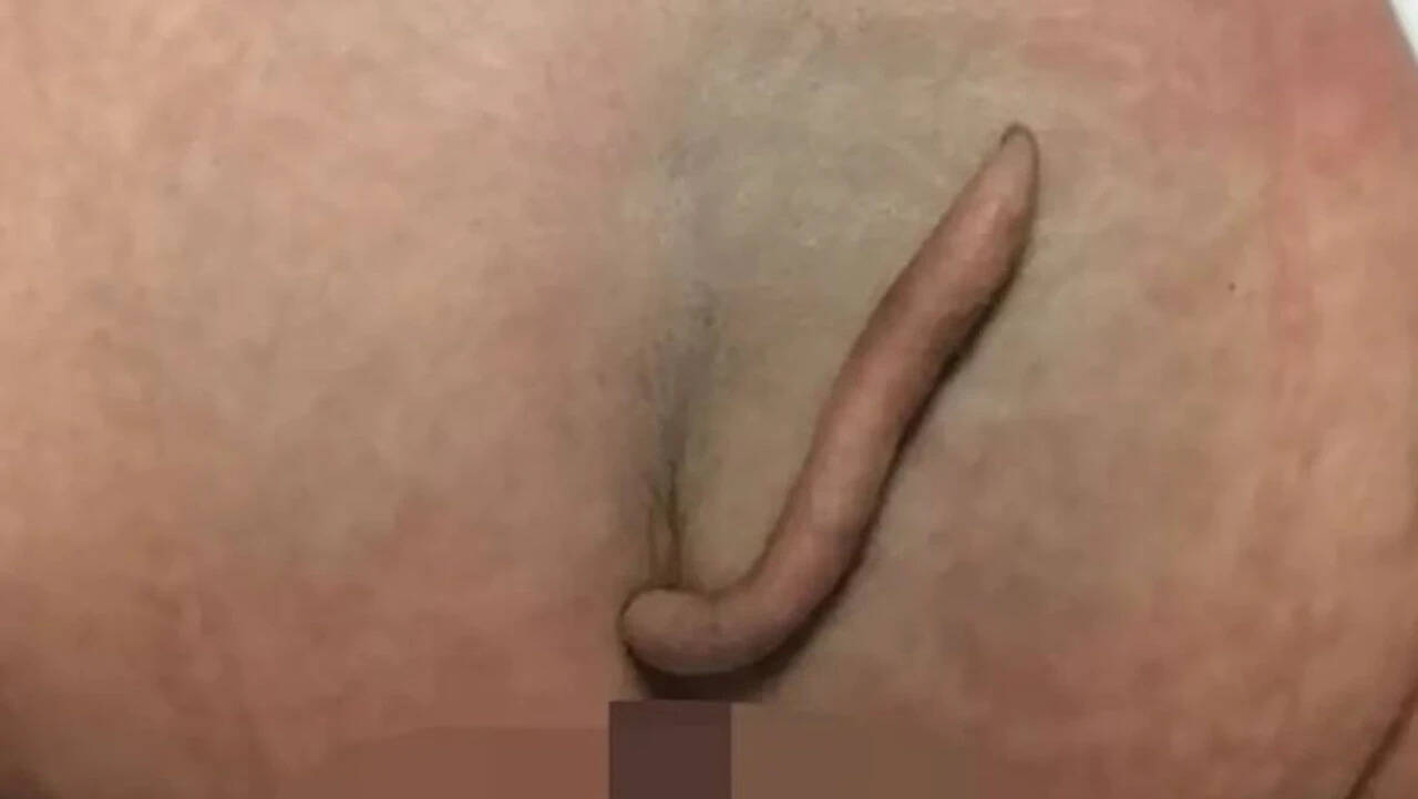 வால் குழந்தை