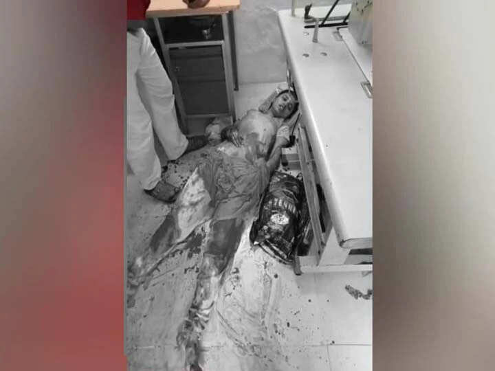 மனைவியின் கைகளை வெட்டிய கணவன்!! பகீர் பிண்ணனி!!