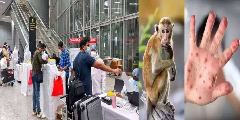 குரங்கு அம்மை