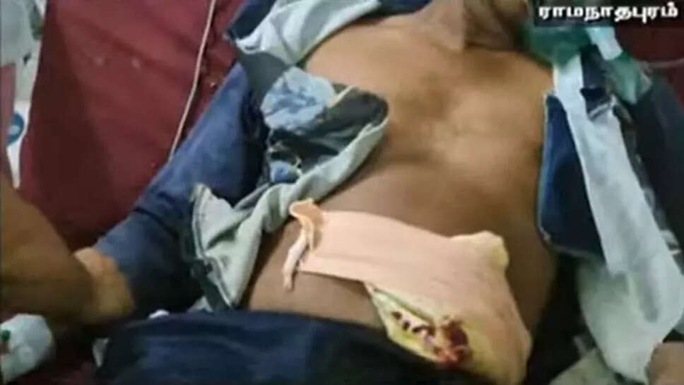 துப்பாக்கி சூடு