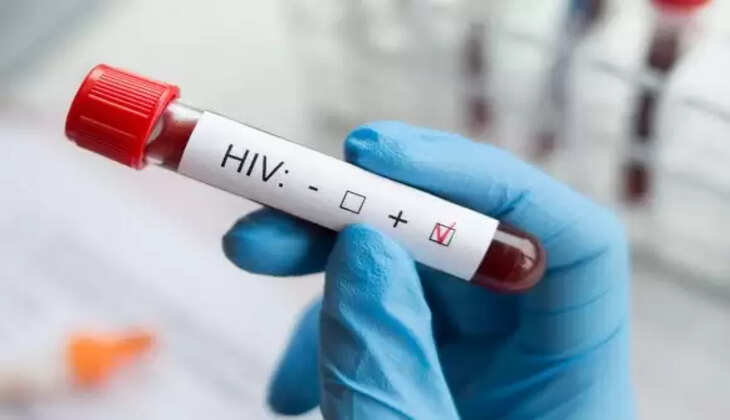 எச்.ஐ.வி