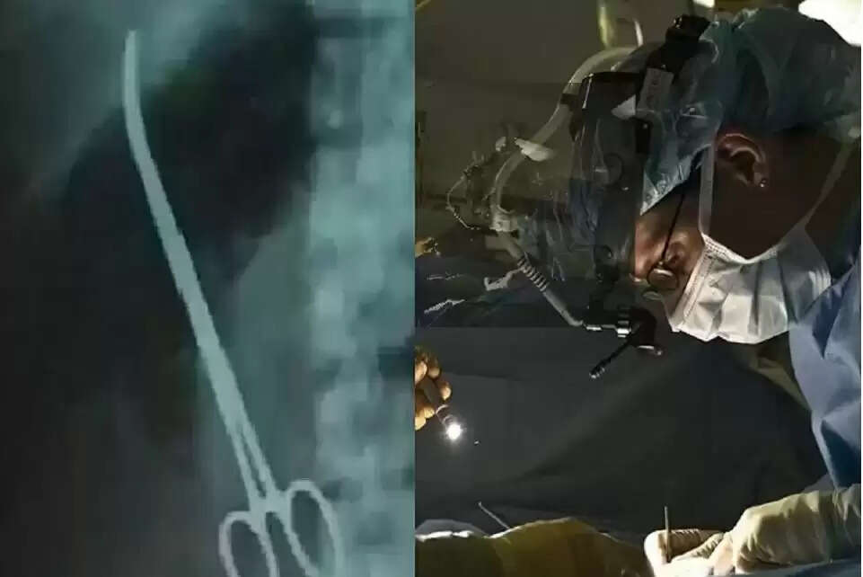 வயிற்றில் கத்திரிக்கோல்