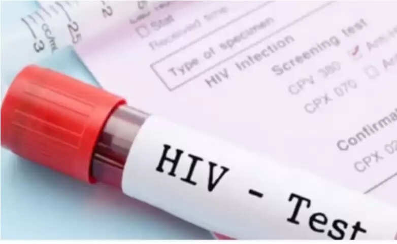 hiv