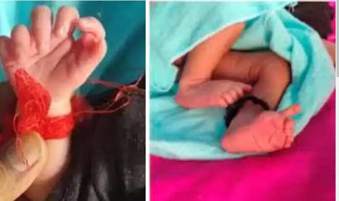 26 விரல் குழந்தை