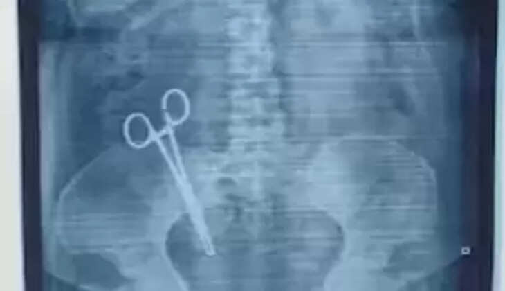 கத்திரிக்கோல்