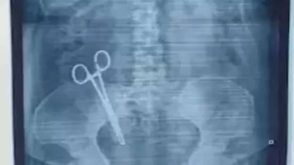 கத்திரிக்கோல்