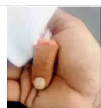 துண்டான விரல்