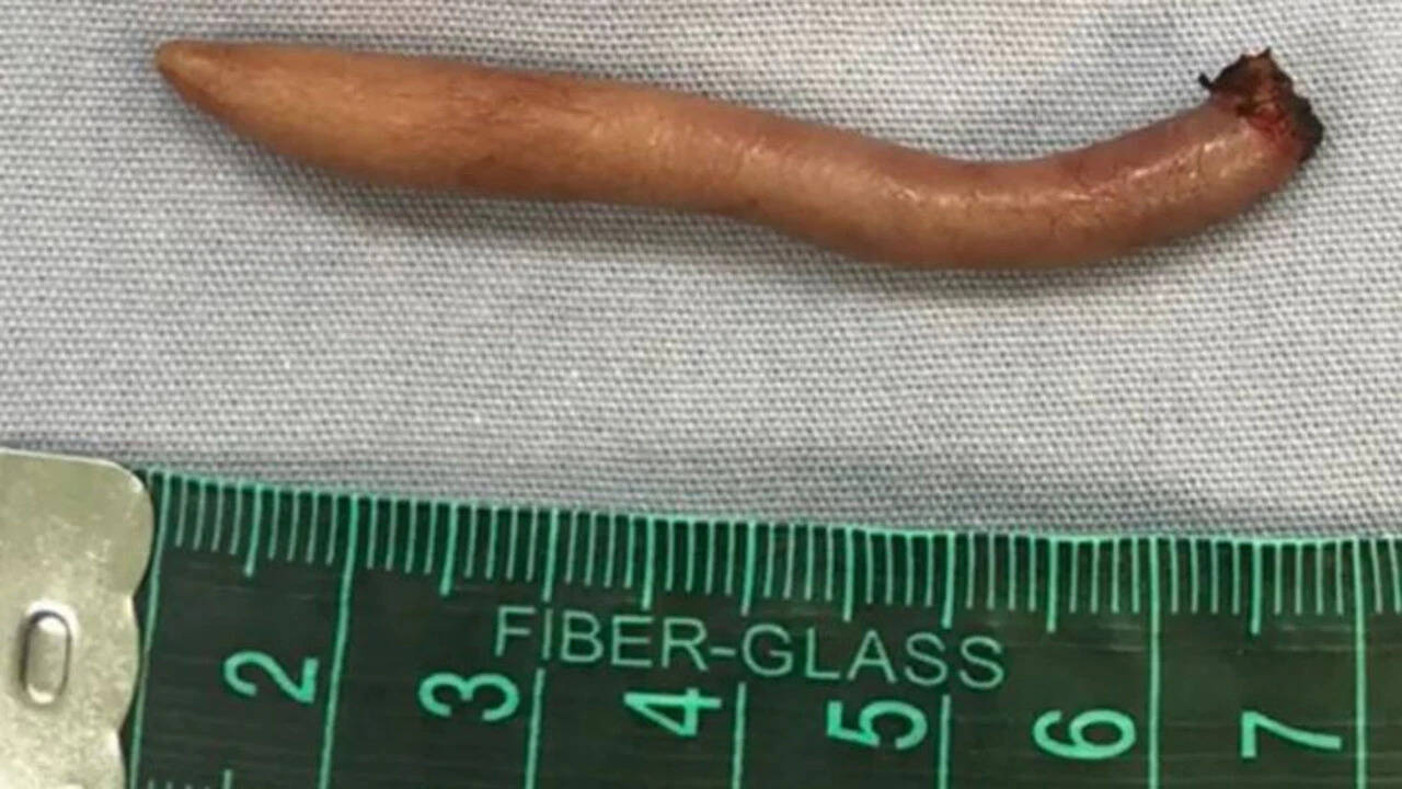 வால் குழந்தை