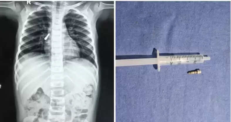 திருகாணி