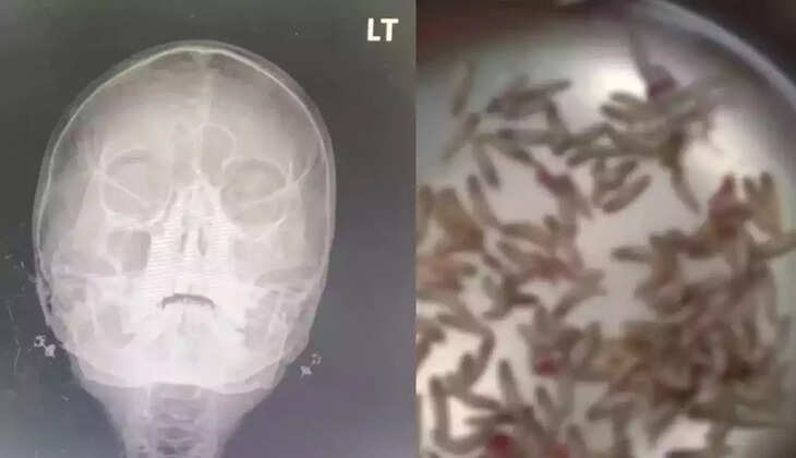  புழுக்கள்