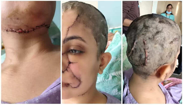 நாய்க்கடி நாய்