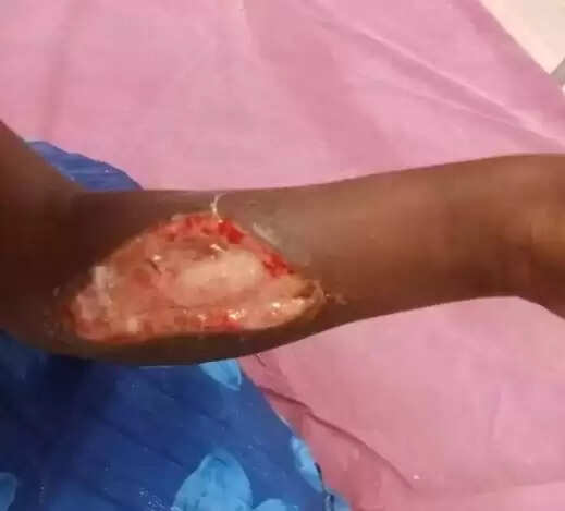 காயம் ஆசிரியை