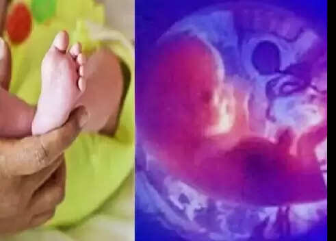 சஞ்சு பகத்