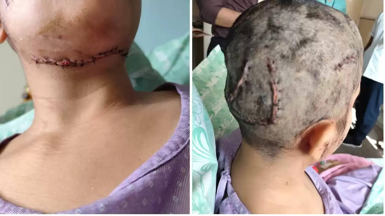 நாய்க்கடி நாய்