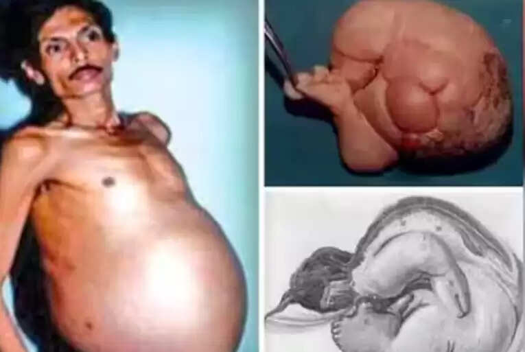 சஞ்சு பகத்