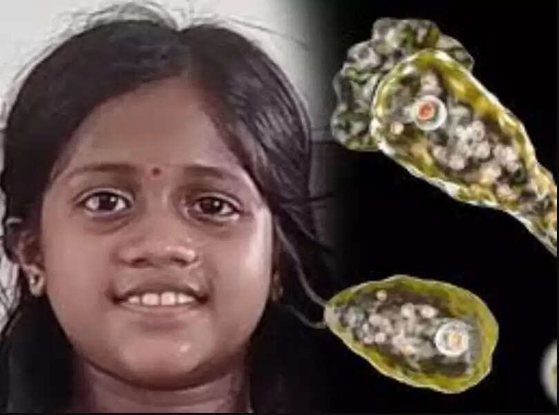 மூளையை தின்னும் அமீபா