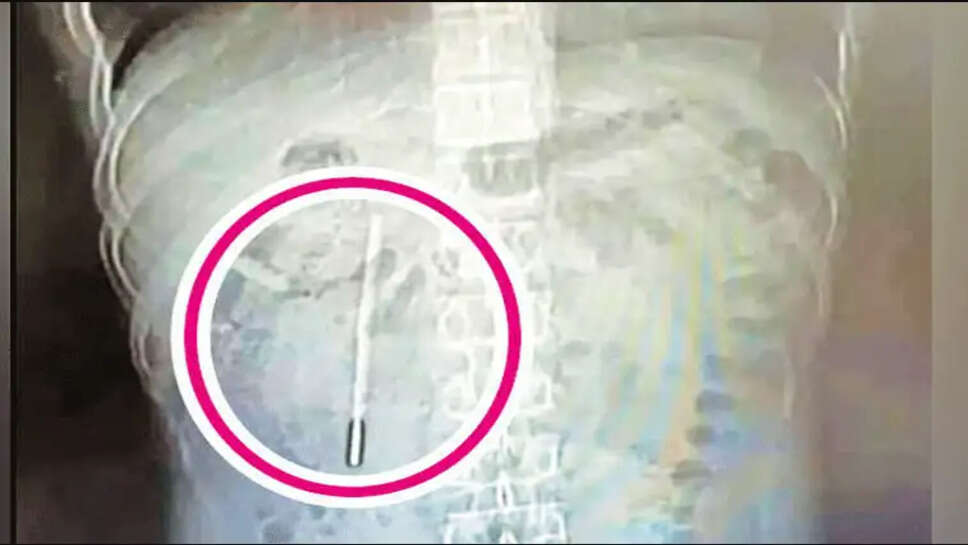 தெர்மாமீட்டர்