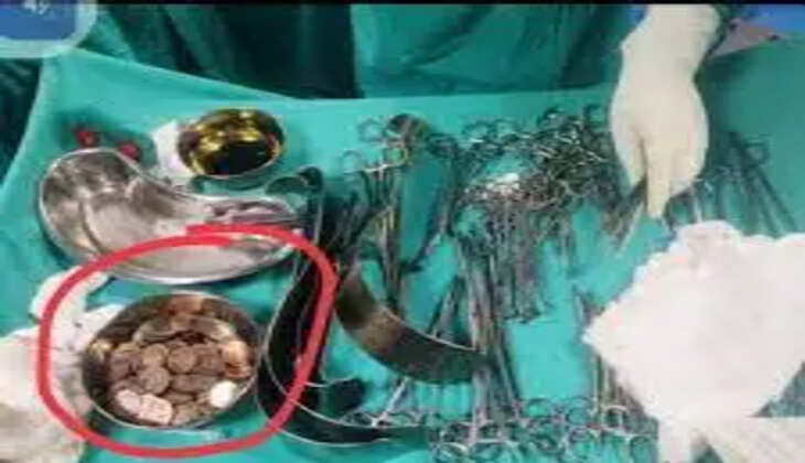 உண்டியல் வயிறு