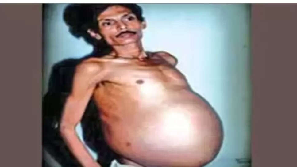 சஞ்சு பகத்