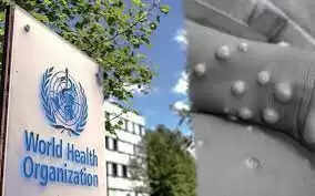 குரங்கு அம்மை