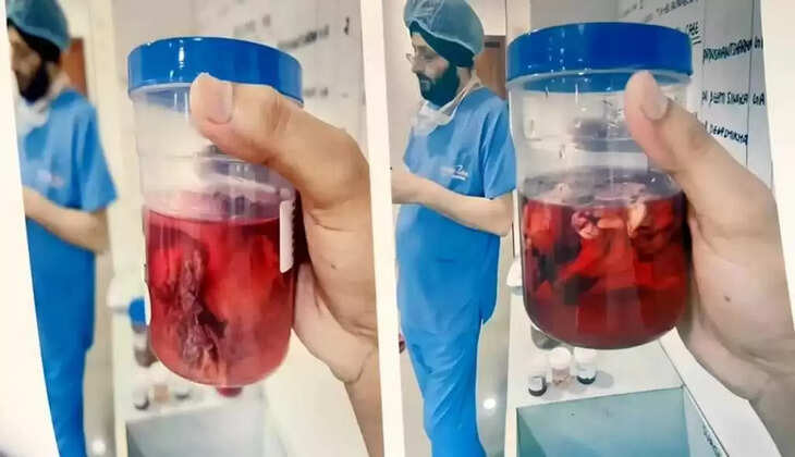  மருத்துவர்களின் அலட்சியம்... அறுவைசிகிச்சை மூலம் குழந்தை… பஞ்சுத்துணியை உள்ளே வைத்து தையல் போட்ட கொடூரம்... பரபரப்பு!  