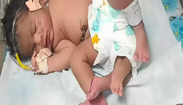 4 கால்கள் குழந்தை