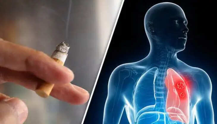 புற்றுநோய்