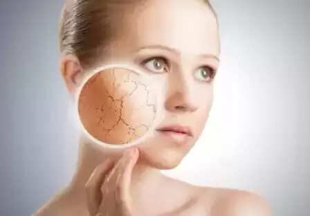 வறட்சியான சருமம்