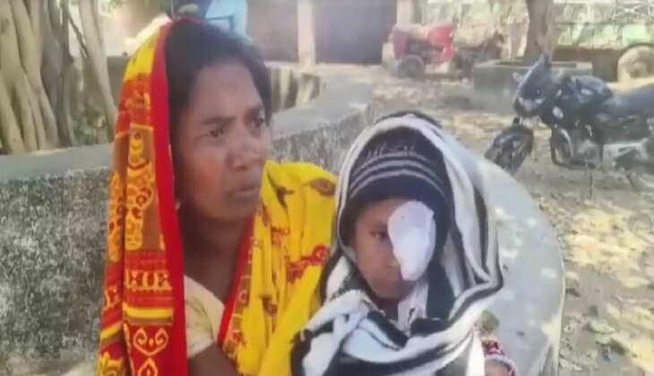 சிப்ஸ் கண்பார்வை கண்