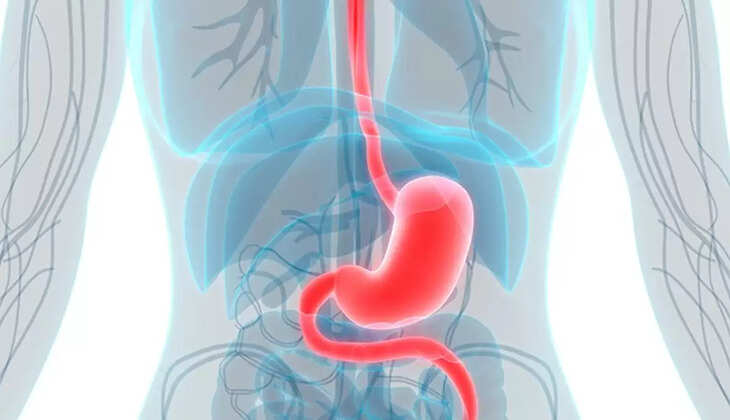 இரைப்பை கேன்சர்