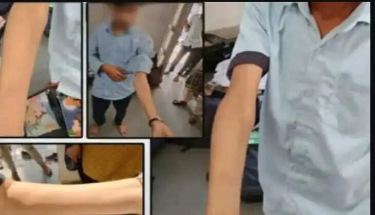 பெற்றோர்களே உஷார்... பள்ளிகளில் டேஞ்சரான டேர் கேம்... 40 மாணவர்கள்  பிளேடால் கையை கீறிக்கொண்ட விபரீதம்...!  