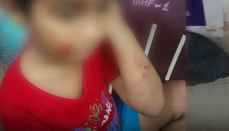 சிறுவன் நாய்க்கடி நாய் தெருநாய்